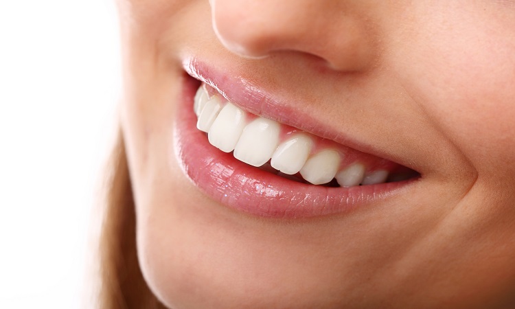How To Keep Porcelain Veneers Clean And White Longer
