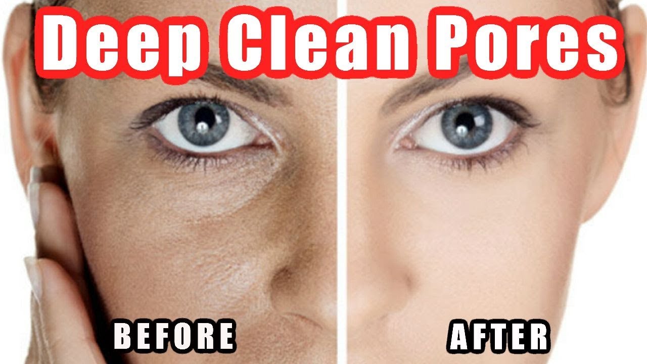 Best Ways to Unclog Pores?