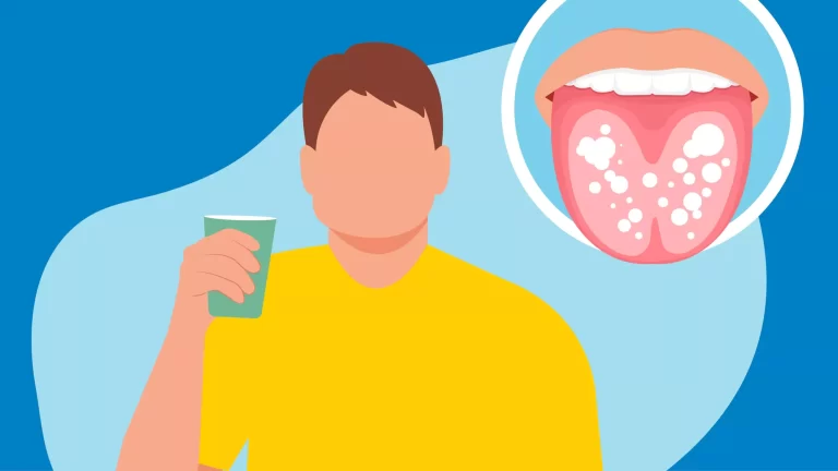 Why Seniors Are More Prone to Fungal Mouth Infections?